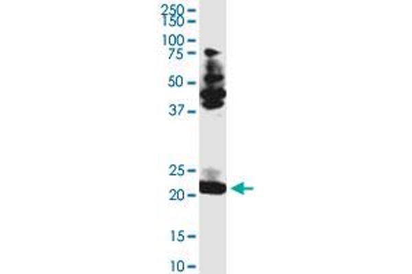 anti-Transcription Elongation Factor A (SII)-Like 3 (TCEAL3) (AA 1-200) antibody