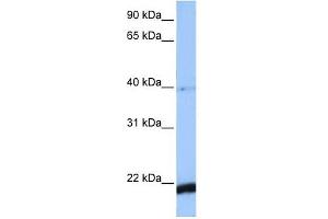 Image no. 1 for anti-HBS1-Like (HBS1L) antibody (ABIN630516)
