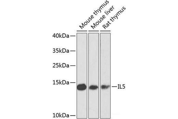 IL-5 antibody