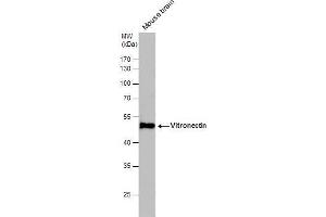 Image no. 3 for anti-Vitronectin (VTN) (Center) antibody (ABIN2855638)