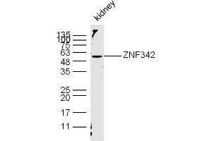 Image no. 1 for anti-Zinc Finger Protein 296 (ZNF296) (AA 231-350) antibody (ABIN1385235)