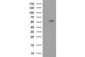 Image no. 2 for anti-Dystrobrevin alpha (DTNA) antibody (ABIN2719781)