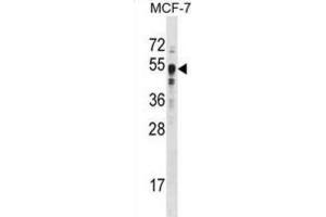 Image no. 3 for anti-SET Domain Containing 8 Pseudogene 1 (SETD8P1) antibody (ABIN2996451)