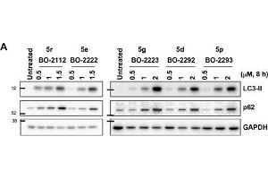 Image no. 115 for anti-Glyceraldehyde-3-Phosphate Dehydrogenase (GAPDH) (Center) antibody (ABIN2857072)