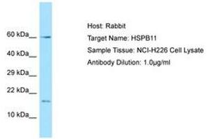 Image no. 1 for anti-Heat Shock Protein Family B (Small), Member 11 (HSPB11) (AA 6-55) antibody (ABIN6749885)