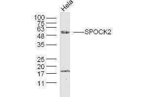 Image no. 2 for anti-Sparc/osteonectin, Cwcv and Kazal-Like Domains Proteoglycan (Testican) 2 (SPOCK2) (AA 61-160) antibody (ABIN1386637)