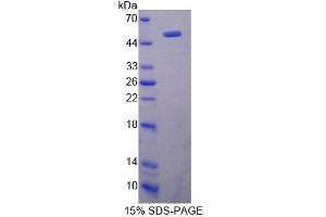 Image no. 1 for HLA-DR-gamma (CD74) (AA 65-277) protein (GST tag,His tag) (ABIN6238494)