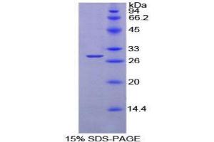 Image no. 1 for Protein tyrosine Phosphatase, Receptor Type, S (PTPRS) (AA 889-1102) protein (His tag) (ABIN1879561)