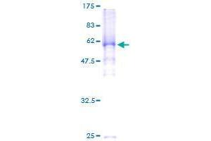 Image no. 1 for Shugoshin 1 (SGOL1) (AA 1-292) protein (GST tag) (ABIN1319839)