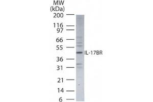 Image no. 1 for anti-Interleukin 17 Receptor B (IL17RB) (AA 102-118) antibody (ABIN233082)