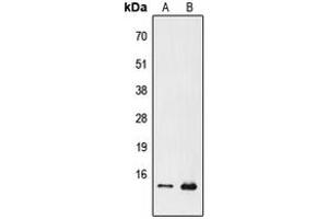 Image no. 1 for anti-Prefoldin Subunit 1 (PFDN1) (N-Term) antibody (ABIN2707698)