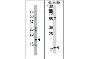 Image no. 1 for anti-Nucleoside diphosphate kinase B (NME2) (N-Term) antibody (ABIN360545)