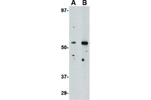Image no. 1 for anti-Plexin Domain Containing 2 (PLXDC2) (N-Term) antibody (ABIN6656335)