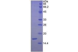 Image no. 1 for Sema Domain, Immunoglobulin Domain (Ig), Short Basic Domain, Secreted, (Semaphorin) 3F (SEMA3F) protein (ABIN3011609)