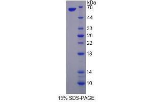 Image no. 1 for serine threonine Kinase 39 (STK39) (AA 63-545) protein (His tag) (ABIN6237655)