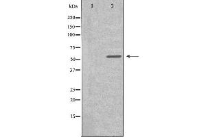 Image no. 1 for anti-Cytochrome P450, Family 2, Subfamily S, Polypeptide 1 (CYP2S1) (Internal Region) antibody (ABIN6258505)