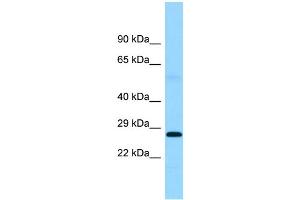 Image no. 1 for anti-Ferritin, Mitochondrial (FTMT) (Middle Region) antibody (ABIN2790357)