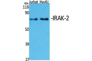 Image no. 2 for anti-Interleukin-1 Receptor-Associated Kinase 2 (IRAK2) (Internal Region) antibody (ABIN3185223)