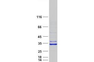 Image no. 1 for Sirtuin 5 (SIRT5) (Transcript Variant 1) protein (Myc-DYKDDDDK Tag) (ABIN2732082)