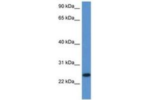 Image no. 1 for anti-Chromosome 1 Open Reading Frame 93 (C1orf93) (AA 96-145) antibody (ABIN6747236)