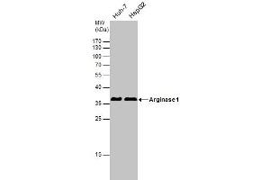 Image no. 4 for anti-Arginase, Liver (ARG1) (full length) antibody (ABIN2856661)