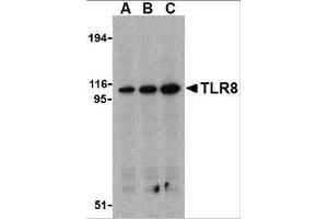 Image no. 1 for anti-Toll-Like Receptor 8 (TLR8) (Internal Region) antibody (ABIN6655850)