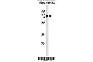 Image no. 1 for anti-Zinc Finger Protein 326 (ZNF326) (AA 127-155), (N-Term) antibody (ABIN1539007)