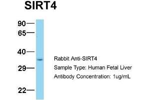 Image no. 1 for anti-Sirtuin 4 (SIRT4) (N-Term) antibody (ABIN2779655)