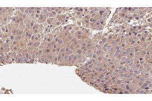 Image no. 2 for anti-Ras-related Protein Ral-A (rala) (C-Term) antibody (ABIN6264624)