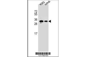Image no. 1 for anti-Homeobox A6 (HOXA6) (AA 105-133) antibody (ABIN655964)