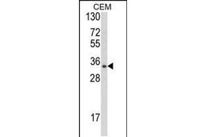 Image no. 3 for anti-Developmental Pluripotency Associated 4 (DPPA4) (AA 50-79), (N-Term) antibody (ABIN5531036)