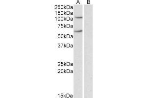 Image no. 1 for anti-Iron-Responsive Element Binding Protein 2 (IREB2) (Internal Region) antibody (ABIN571014)