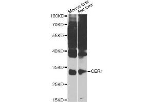 Image no. 1 for anti-Cerberus 1 Homolog (Xenopus Laevis) (CER1) antibody (ABIN6571088)