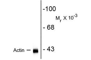Image no. 1 for anti-Actin, alpha 1, Skeletal Muscle (ACTA1) antibody (ABIN361349)