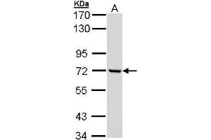 Image no. 1 for anti-Complement Component 1, R Subcomponent (C1R) (Center) antibody (ABIN2855811)