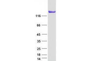 Image no. 1 for High Density Lipoprotein Binding Protein (HDLBP) (Transcript Variant 1) protein (Myc-DYKDDDDK Tag) (ABIN2735260)