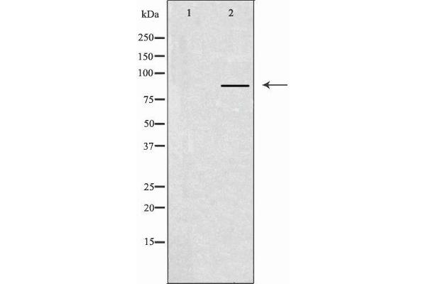 anti-Chloride Channel, Voltage-Sensitive 7 (CLCN7) (N-Term) antibody