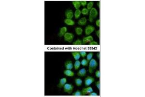 ICC/IF Image Immunofluorescence analysis of methanol-fixed A431, using COX5A, antibody at 1:200 dilution.