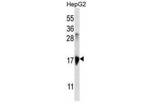 Image no. 1 for anti-Keratin Associated Protein 1-3 (KRTAP1-3) (AA 95-125), (Middle Region) antibody (ABIN953118)