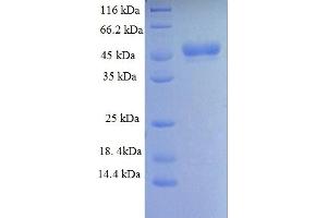 Image no. 1 for Histone Deacetylase 4 (HDAC4) (AA 1-227), (partial) protein (GST tag) (ABIN5713106)