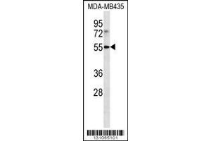 Image no. 1 for anti-Leukocyte Immunoglobulin-Like Receptor, Subfamily B (With TM and ITIM Domains), Member 4 (LILRB4) (AA 44-73), (N-Term) antibody (ABIN656231)