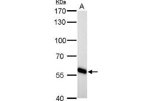 Image no. 4 for anti-Cytochrome P450, Family 27, Subfamily A, Polypeptide 1 (CYP27A1) (Center) antibody (ABIN2855688)