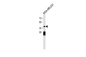 Mu Opioid Receptor 1 antibody  (AA 161-187)