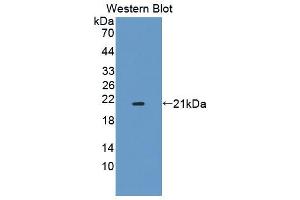 Image no. 1 for anti-Dystrophia Myotonica-Protein Kinase (DMPK) (AA 1-152) antibody (ABIN5013479)