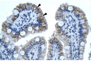 Image no. 3 for anti-Gap Junction Protein, beta 1, 32kDa (GJB1) (C-Term) antibody (ABIN2774855)