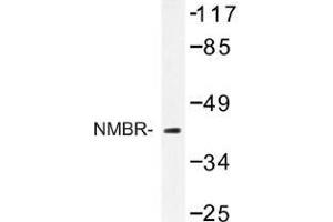 Image no. 1 for anti-Neuromedin B Receptor (NMBR) antibody (ABIN317709)