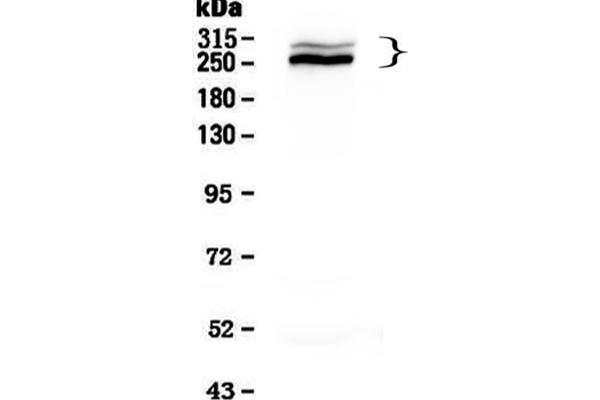 anti-Desmoplakin (DSP) (AA 1810-2092) antibody