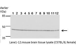 Image no. 6 for anti-Creatine Kinase, Brain (CKB) (Center) antibody (ABIN2855158)