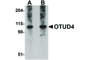 Image no. 1 for anti-OTU Domain Containing 4 (OTUD4) (C-Term) antibody (ABIN6657189)