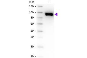 Image no. 1 for anti-Plasminogen (PLG) antibody (ABIN105702)